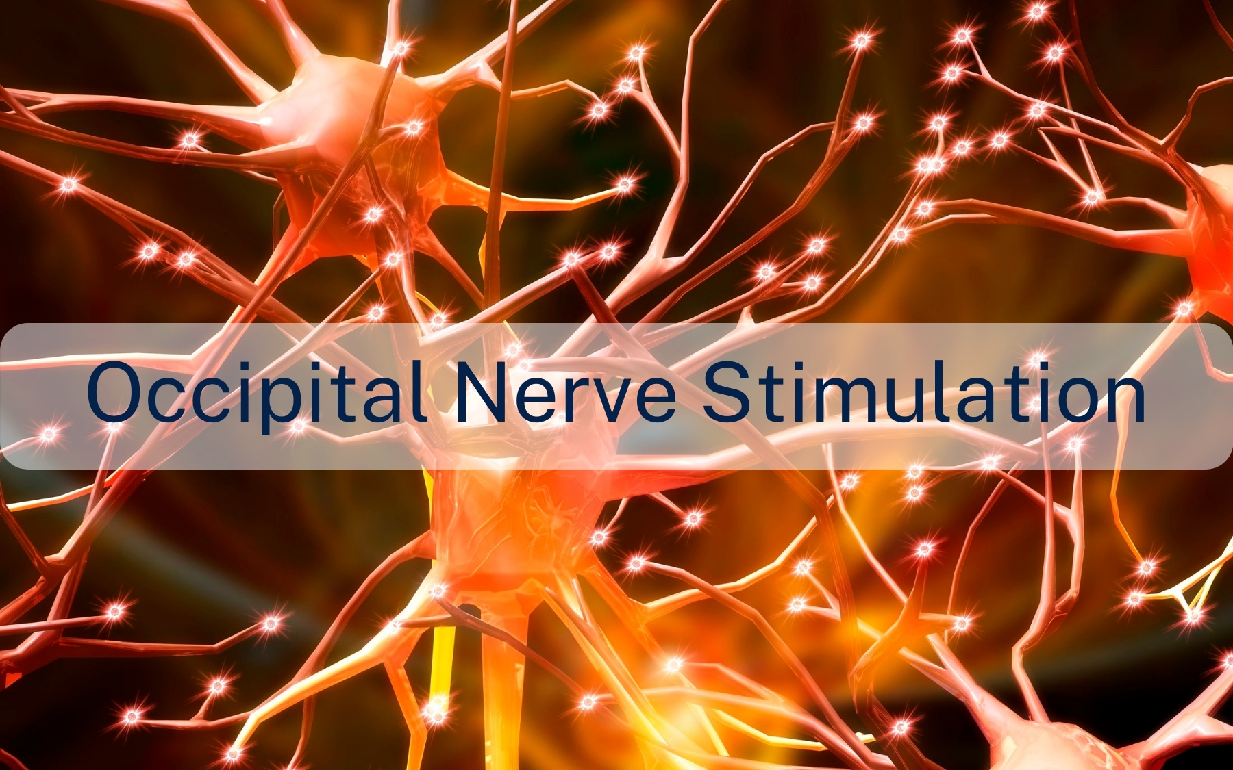 Occipital nerve stimulation